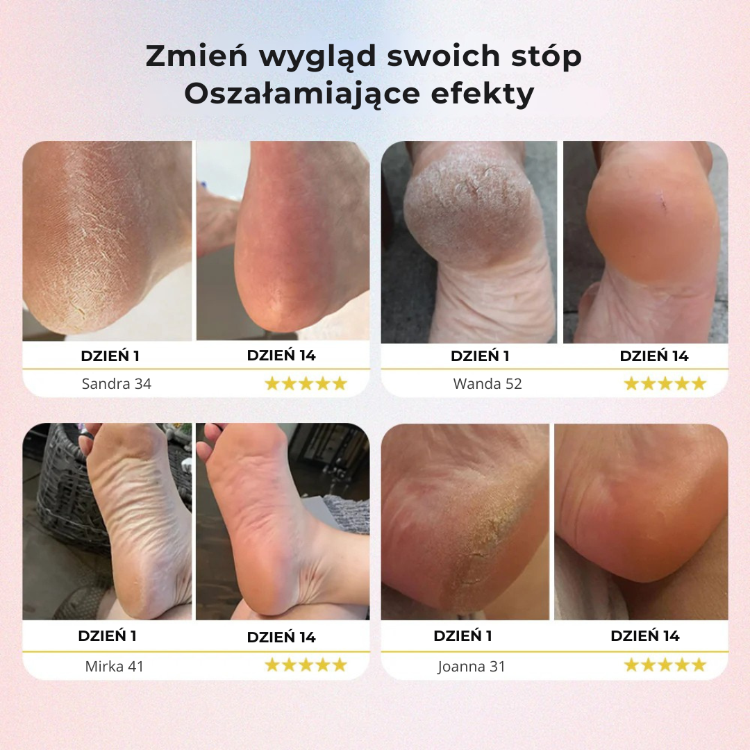 DermaScrub™ -elektryczna maszynka do usuwania zrogowaciałego naskórka ze stóp