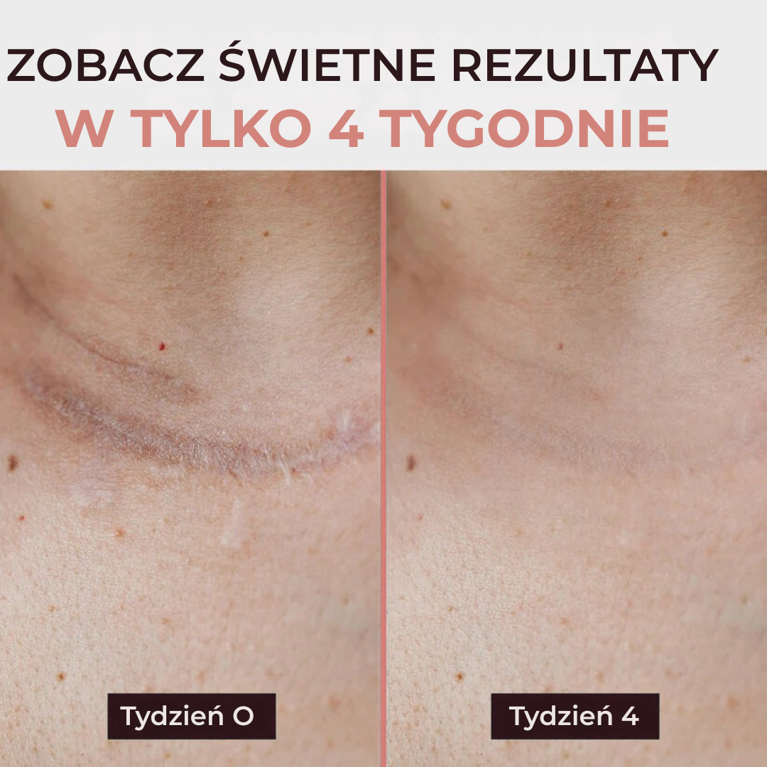 DermaTape™ -silikonowa taśma na zmarszczki i blizny