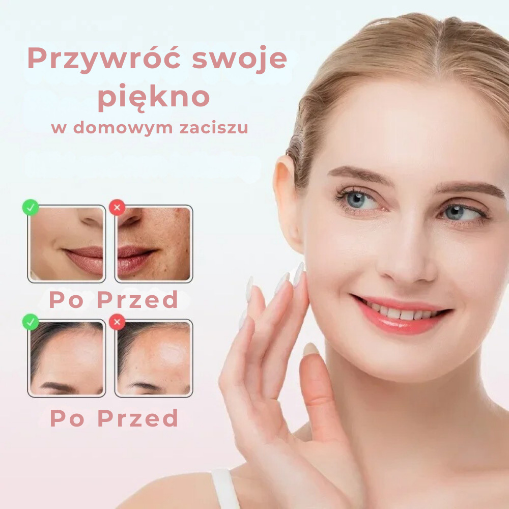 DermaCleaner™-próżniowe urządzenie do oczyszczania porów i skóry twarzy