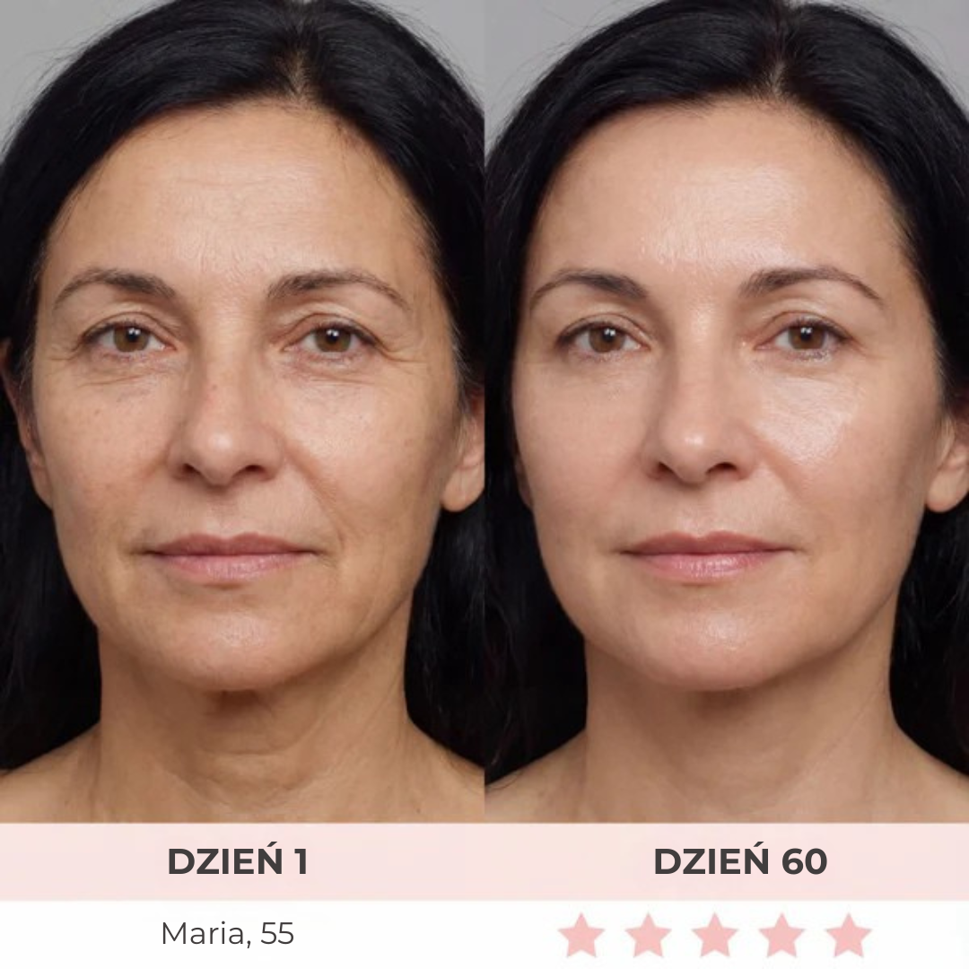 DermaLifting - masażer ze światłem led do liftingu twarzy i szyi