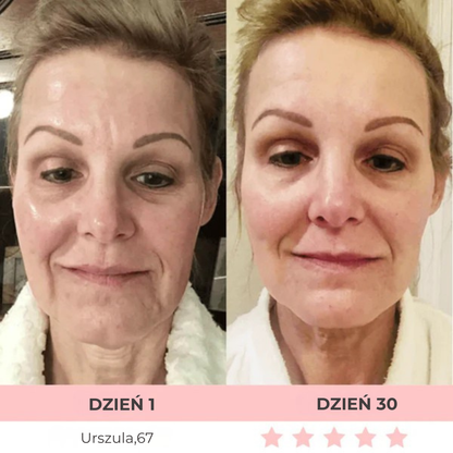 DermaLifting - masażer ze światłem led do liftingu twarzy i szyi