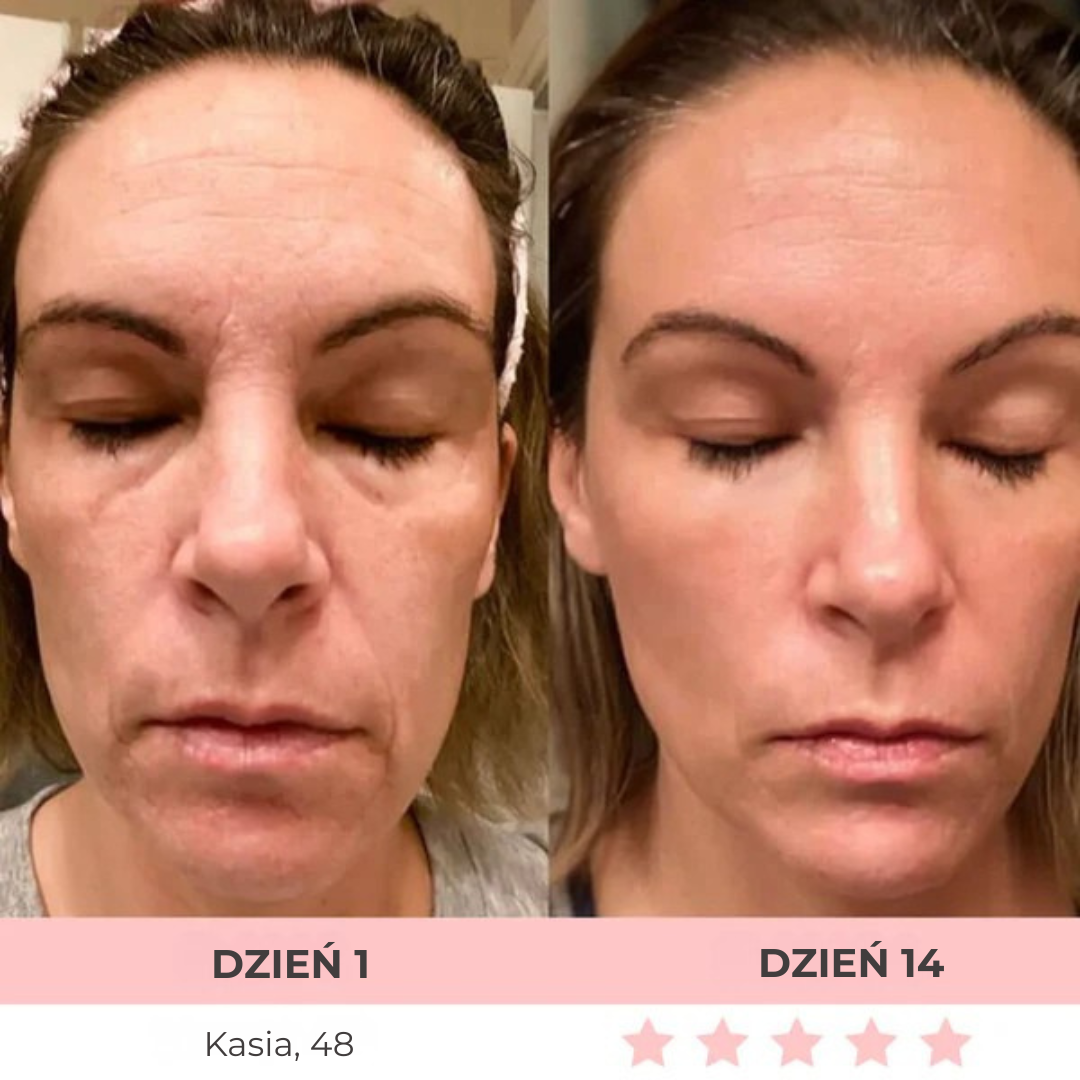 DermaLifting - masażer ze światłem led do liftingu twarzy i szyi