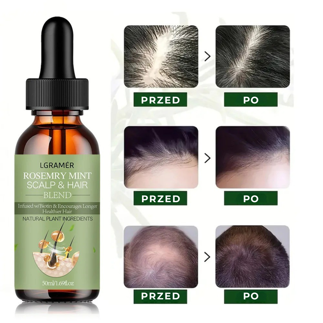 Olejek Rozmarynowy - rewelacyjny olejek przeciw wypadaniu i na porost włosów