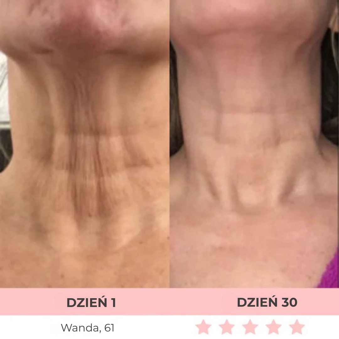 DermaLifting - masażer ze światłem led do liftingu twarzy i szyi