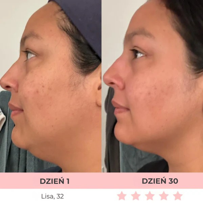 DermaLifting - masażer ze światłem led do liftingu twarzy i szyi