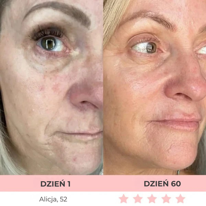 DermaLifting - masażer ze światłem led do liftingu twarzy i szyi