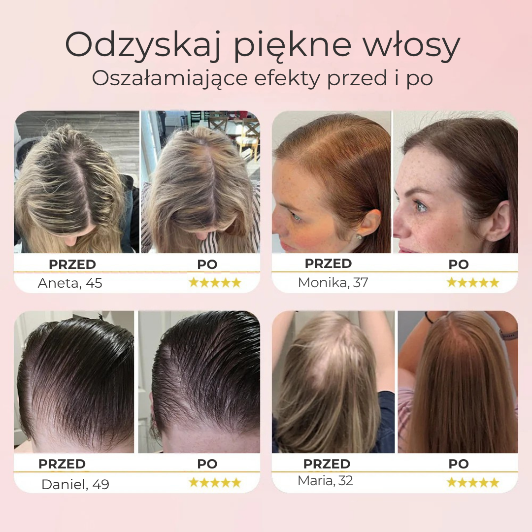 DermaBrush™ - innowacyjna szczotka na porost włosów