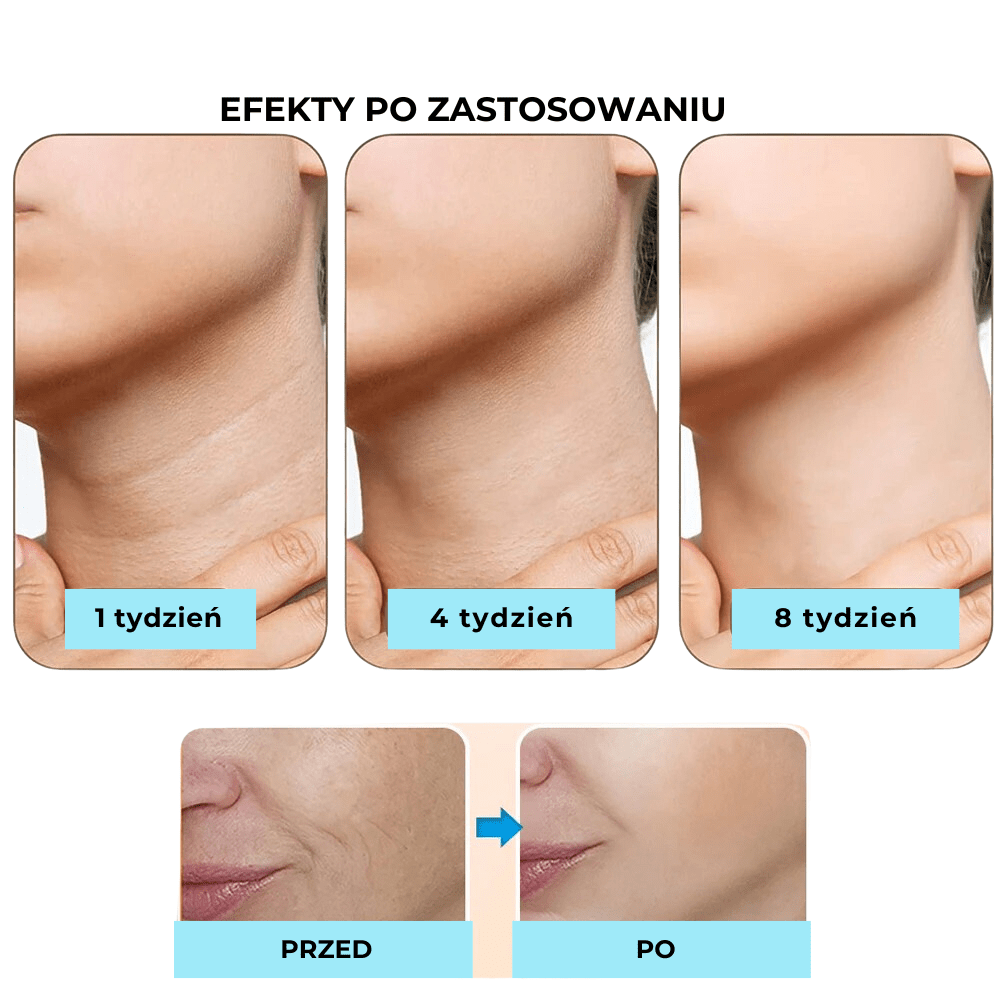 DermaLifting - masażer ze światłem led do liftingu twarzy i szyi - Derma Beauty