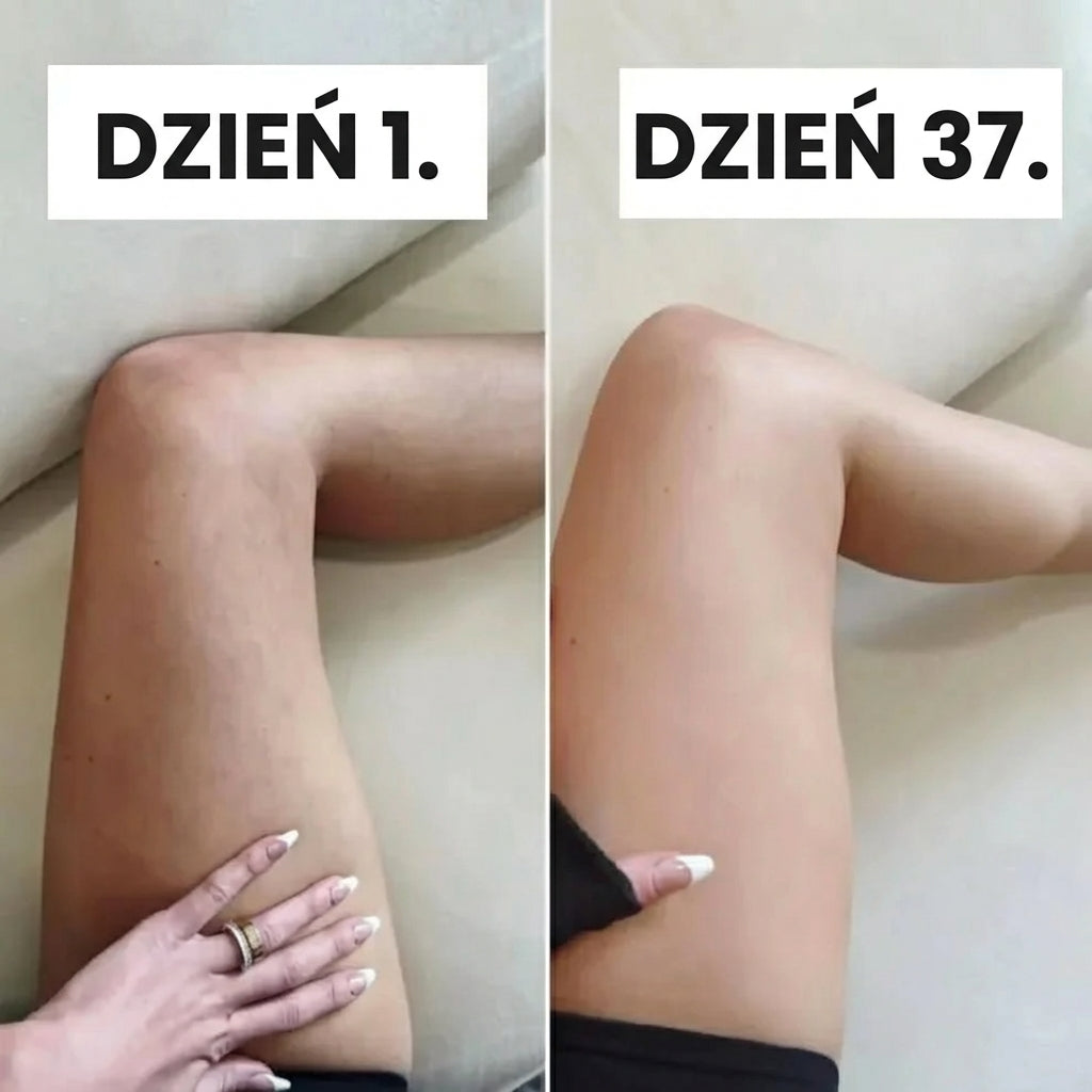 DermaCell™ - próżniowy masażer do cellulitu
