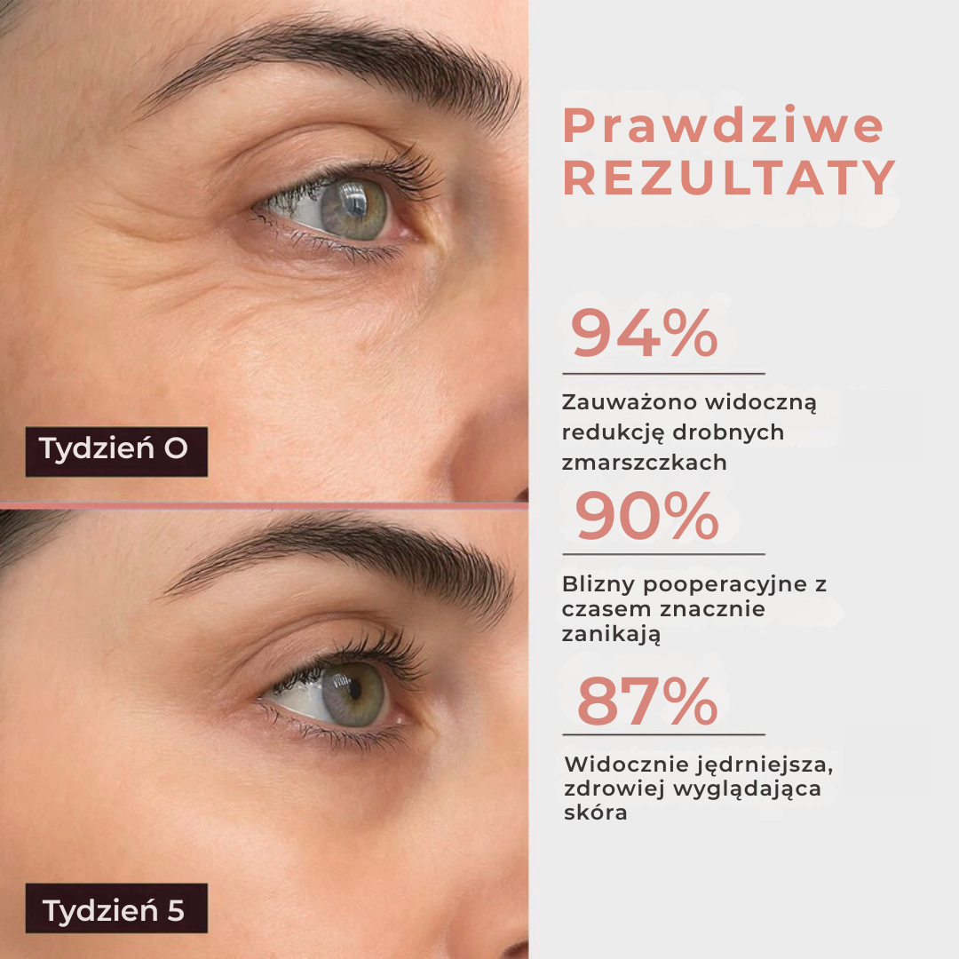 DermaTape™ -silikonowa taśma na zmarszczki i blizny